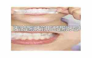 牙贴是刷牙前还是后啊