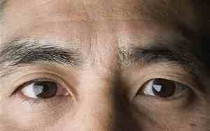 男人眼凹陷命运