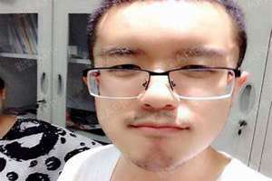 眉骨突出图片像猿人(眉骨突出图片)