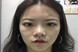 女人鼻子大为什么不能要(鼻子大的女人说明什么)