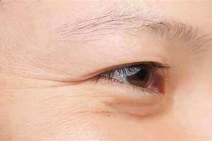 眼角有皱纹怎么消除小妙招(眼角有皱纹)