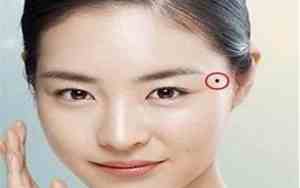 女人右边太阳旁边长痣图解