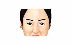 女人脸下垂